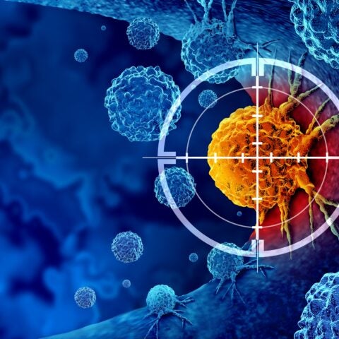 Cancer detection and screening as a treatment for malignant cells with a biopsy or testing caused by carcinogens and genetics with a cancerous cell as an immunotherapy symbol as a 3D render.