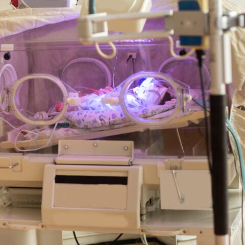 The premature little baby in an incubator at the neonatal section of the maternity.